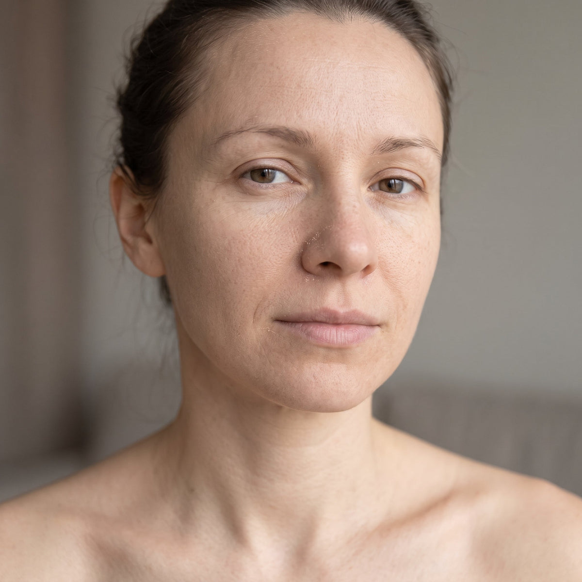 Dehydrated Skin